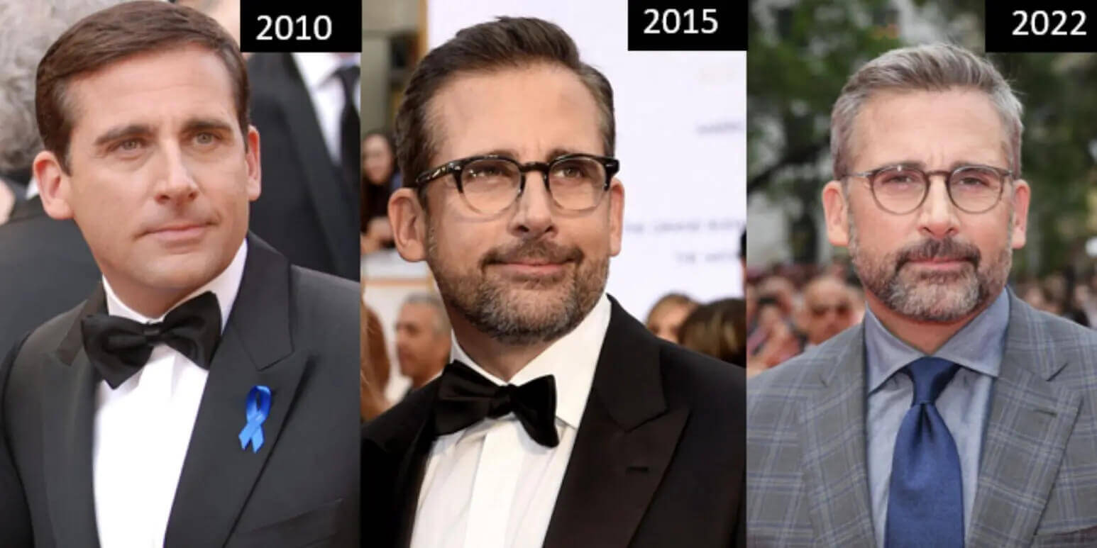 Steve Carell Hair Transplant: The Transformation Everyone Noticed